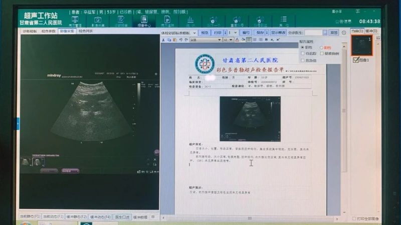 男性体检项目标准怎么选